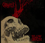 Carnifex, video lyrics du second titre du prochain album! 